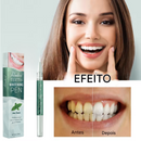 Caneta Clareia Já - Dentes Brancos e Brilhantes - SUPER PROMOÇÃO | FRETE GRÁTIS | COMPRE 1 LEVE 2