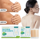 CicatriMax™ 3D - Fita de Silicone Cicatrizante 6 Em 1