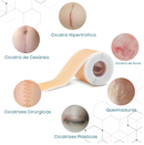 CicatriMax™ 3D - Fita de Silicone Cicatrizante 6 Em 1